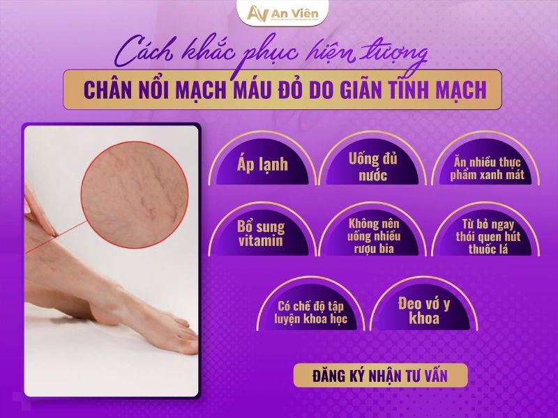 nổi mạch máu đỏ ở chân
