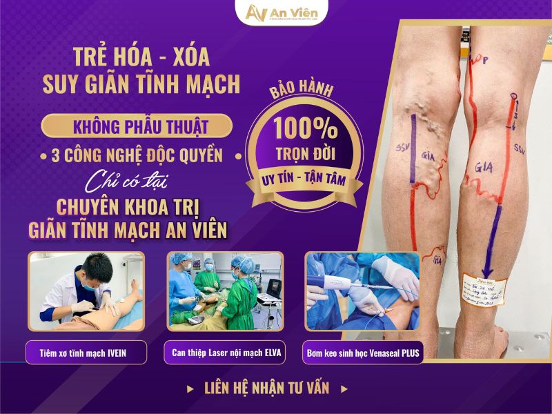 phòng khám Tĩnh mạch Đà Nẵng
