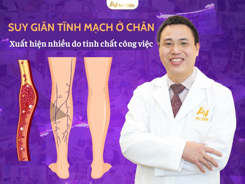 bệnh suy giãn tĩnh mạch ở chân