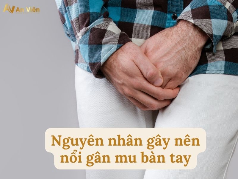 cách điều trị nổi gân mu bàn tay