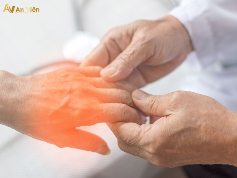 cách điều trị nổi gân mu bàn tay