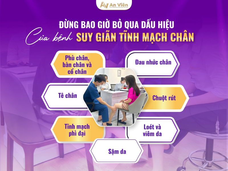 dấu hiệu bị giãn tĩnh mạch chân