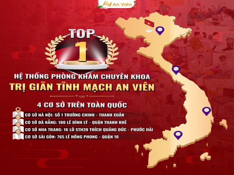 điều trị giãn tĩnh mạch chi dưới