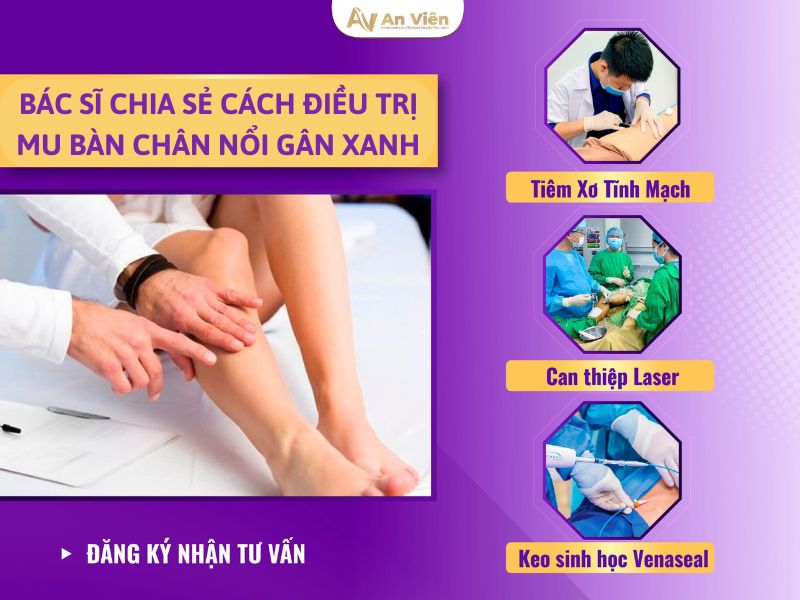 mu bàn chân nổi gân xanh