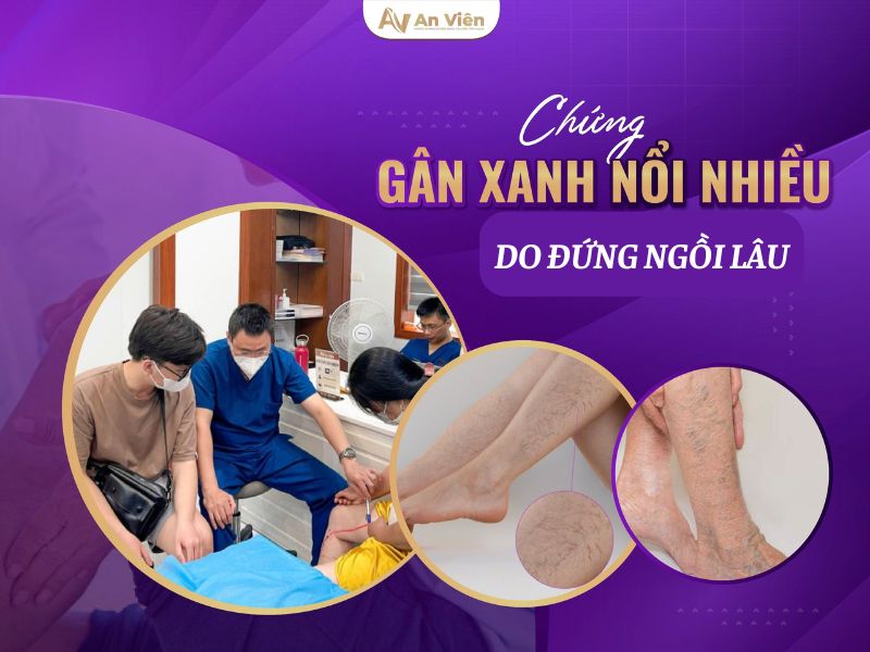 mu bàn chân nổi gân xanh