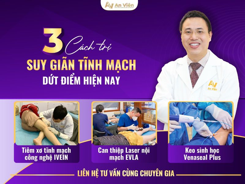 suy giãn tĩnh mạch chi dưới và cách điều trị