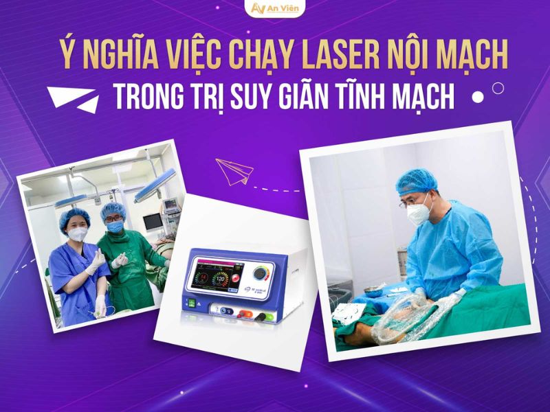 suy giãn tĩnh mạch chi dưới và cách điều trị