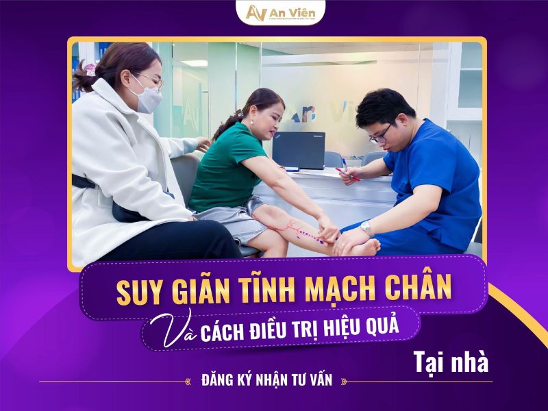 suy giãn tĩnh mạch chi dưới và cách điều trị