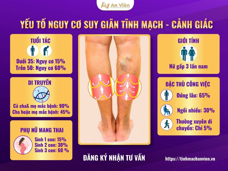 tác hại của bệnh suy giãn tĩnh mạch