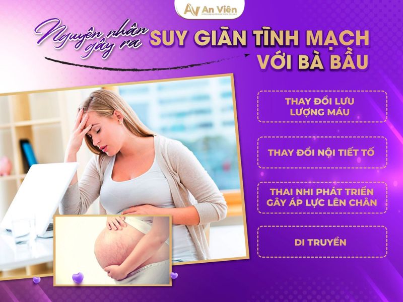 bầu bị giãn tĩnh mạch phải làm sao
