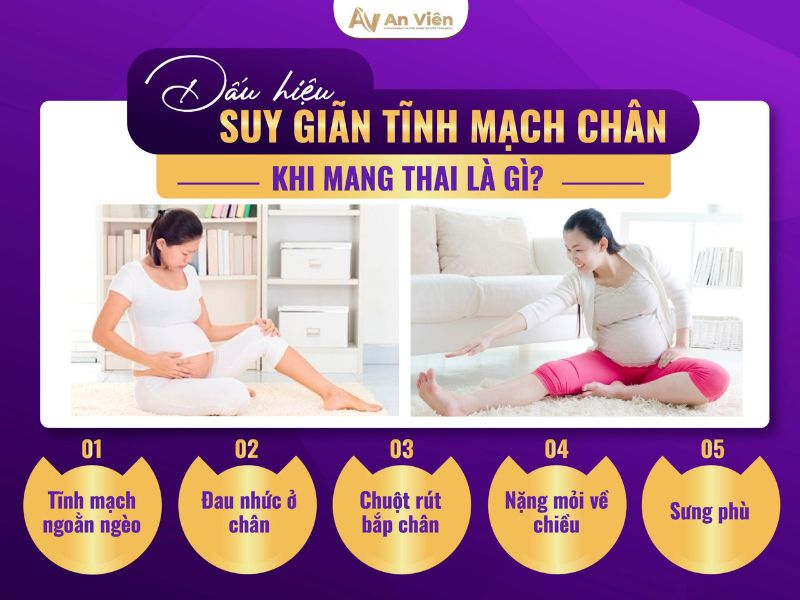 bầu bị giãn tĩnh mạch phải làm sao