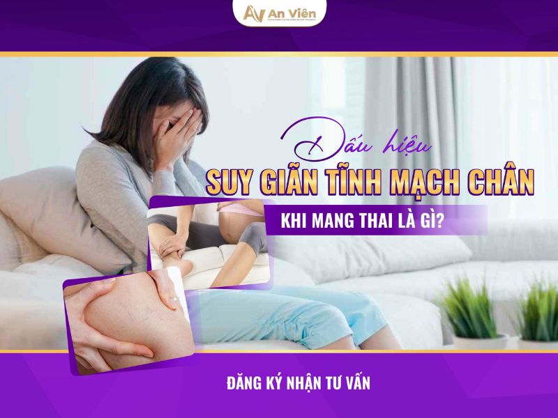bầu bị giãn tĩnh mạch phải làm sao