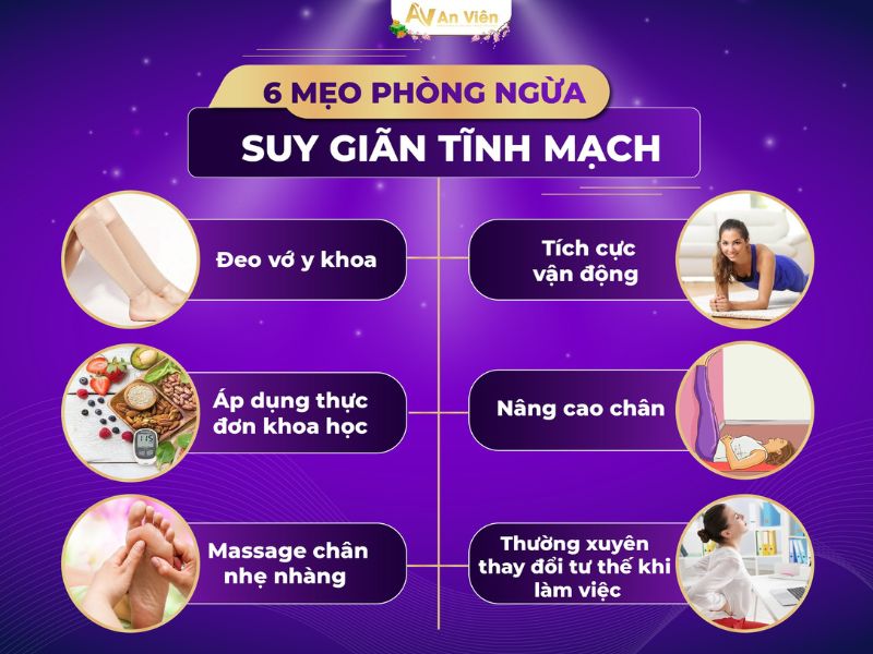 bị giãn tĩnh mạch chân có sao không