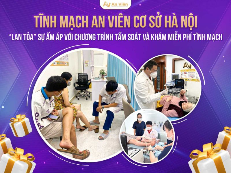 cách chống giãn tĩnh mạch chân