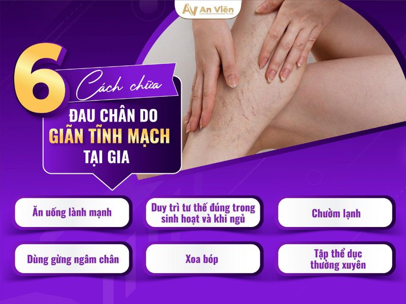 cách chống giãn tĩnh mạch chân