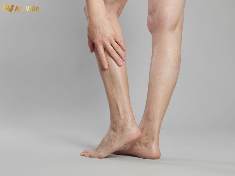 cách trị nổi gân tay chân