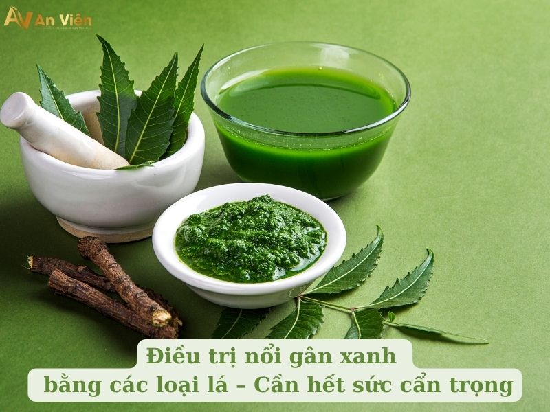 cách trị nổi gân tay chân