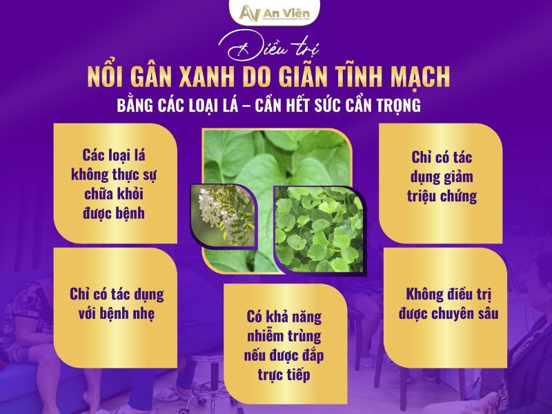 cách trị nổi gân tay chân