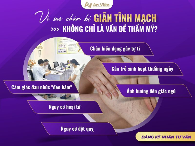 chân bị suy giãn tĩnh mạch