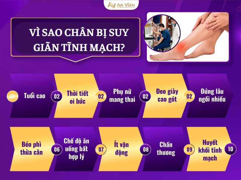 chân bị suy giãn tĩnh mạch