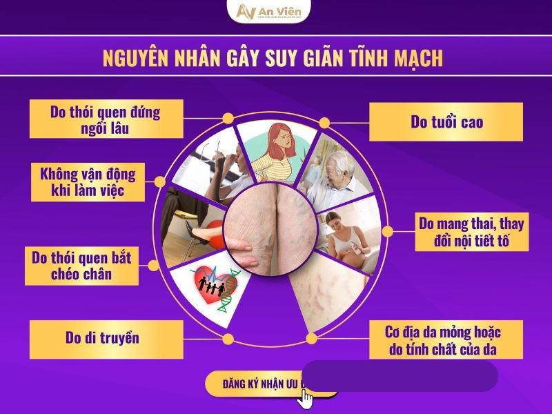 giãn tĩnh mạch chi dưới là gì