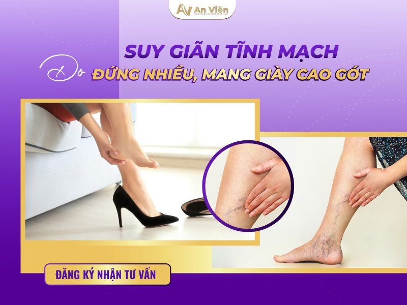 suy giãn tĩnh mạch do đâu
