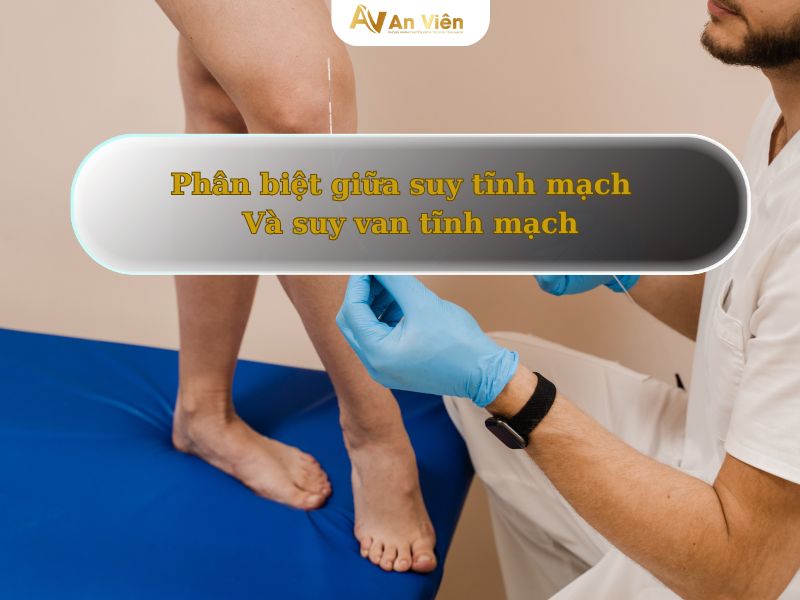 suy tĩnh mạch là gì