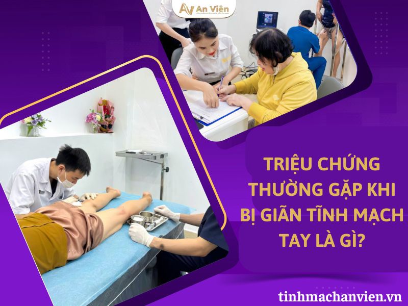 tắc tĩnh mạch tay