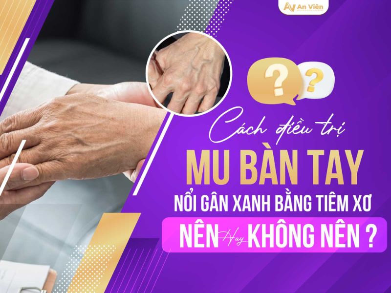 tắc tĩnh mạch tay
