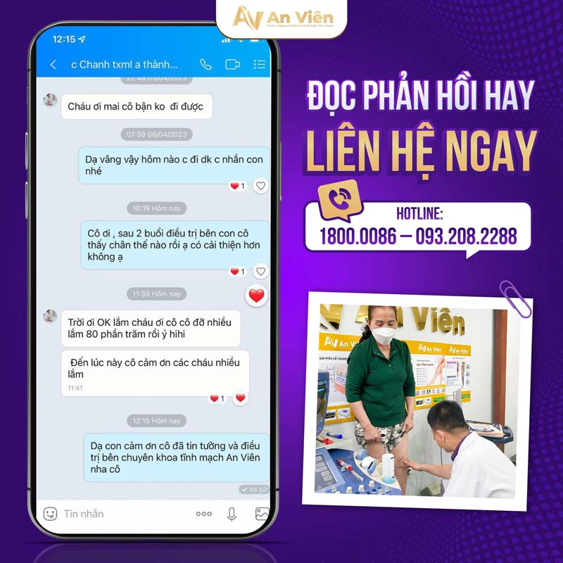 bệnh suy tĩnh mạch