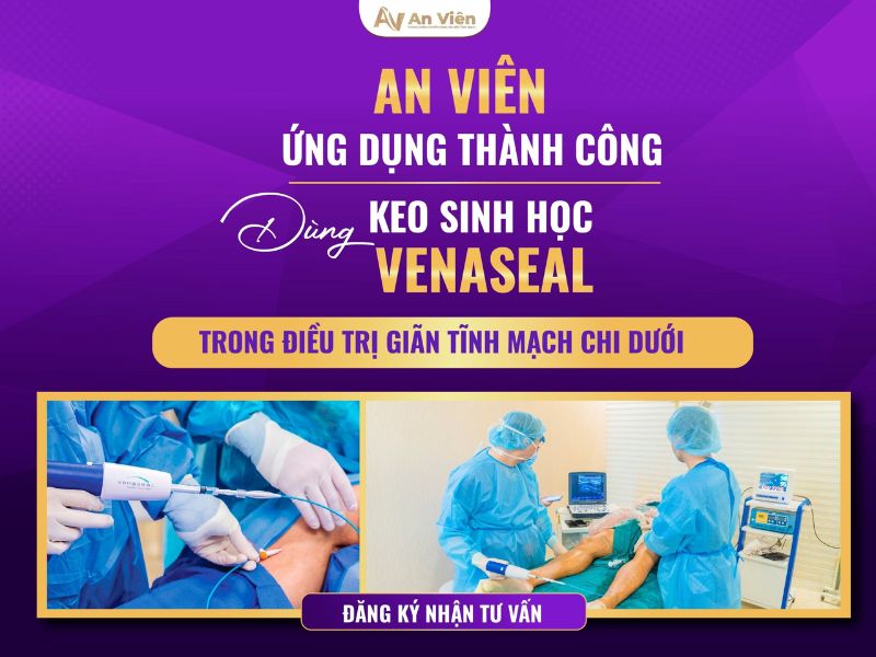 bệnh suy tĩnh mạch