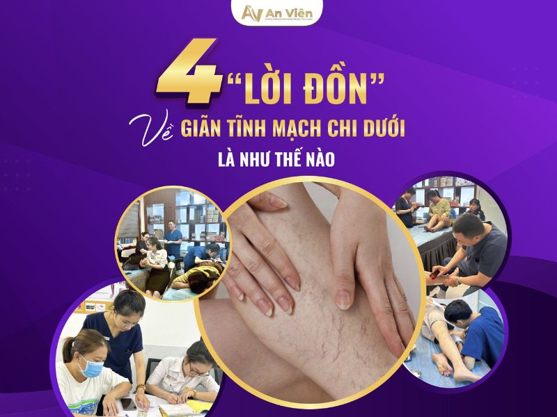 bị giãn tĩnh mạch có sao không
