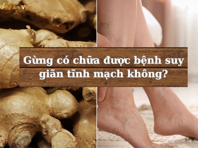 cách điều trị giãn tĩnh mạch chi dưới