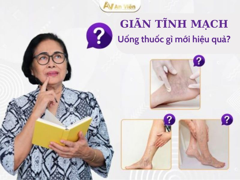 cách trị suy giãn tĩnh mạch ở chân