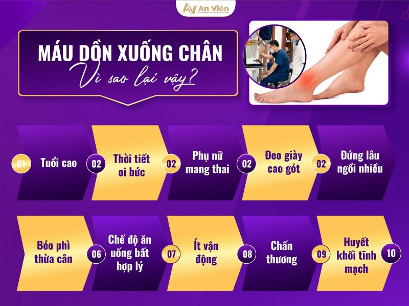 chân bị nổi gân xanh phải làm sao