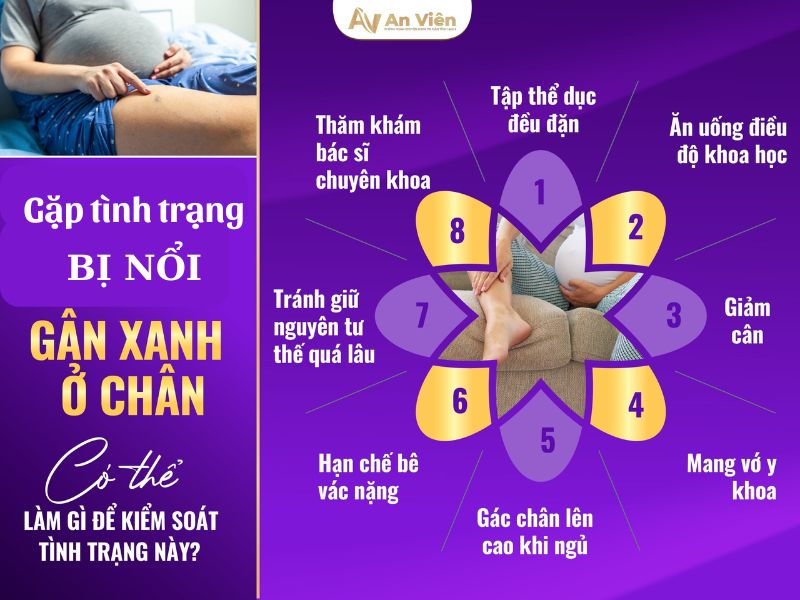 chân bị nổi gân xanh phải làm sao