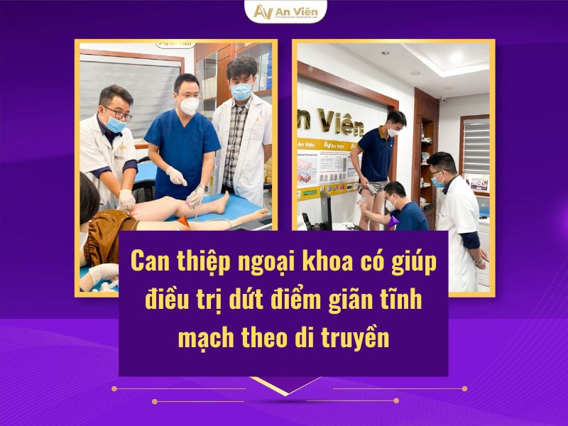 giãn tĩnh mạch có chữa được không
