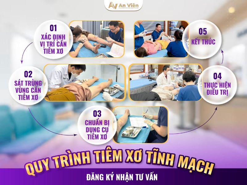 giãn tĩnh mạch chân điều trị