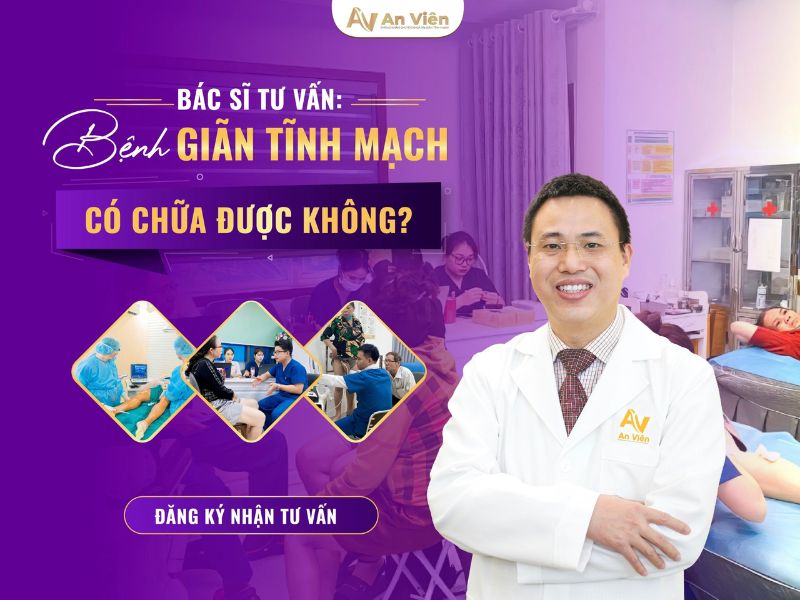 giãn tĩnh mạch chân kiêng gì