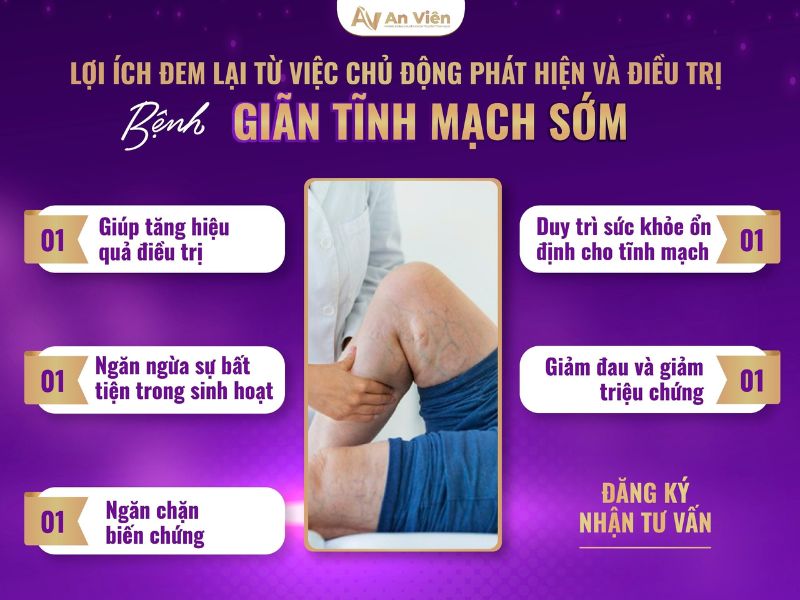 giãn tĩnh mạch chân triệu chứng