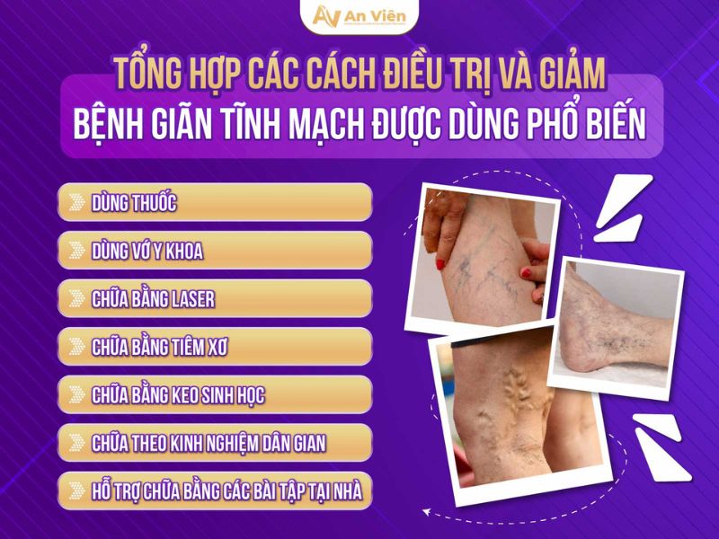 bệnh giãn tĩnh mạch chân có nguy hiểm không