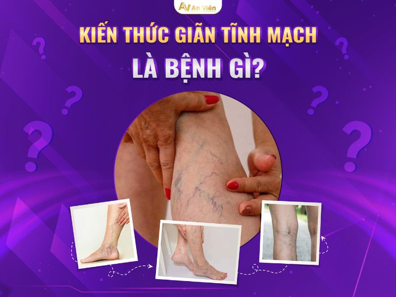 bệnh lý giãn tĩnh mạch chi dưới