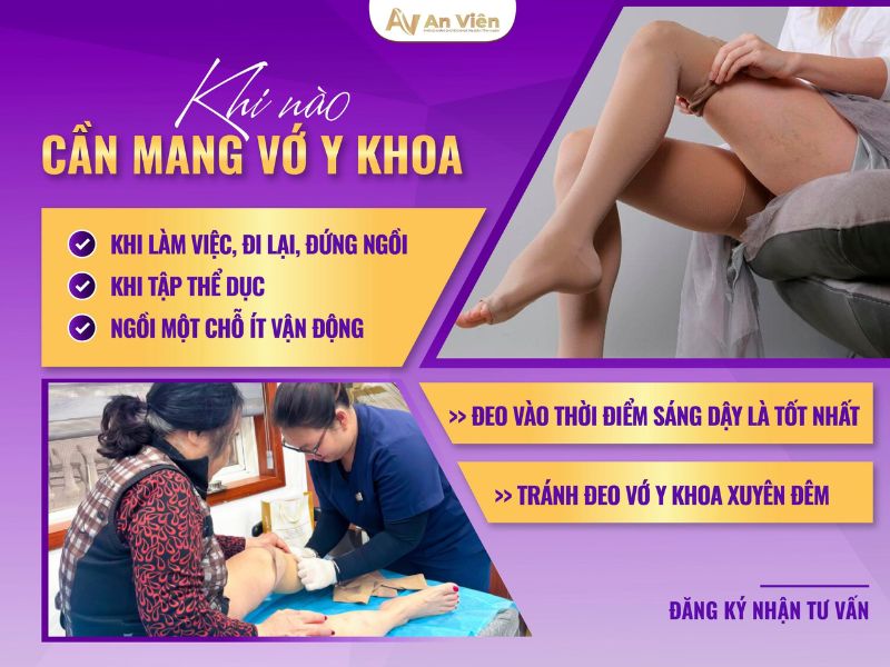cách làm giảm giãn tĩnh mạch