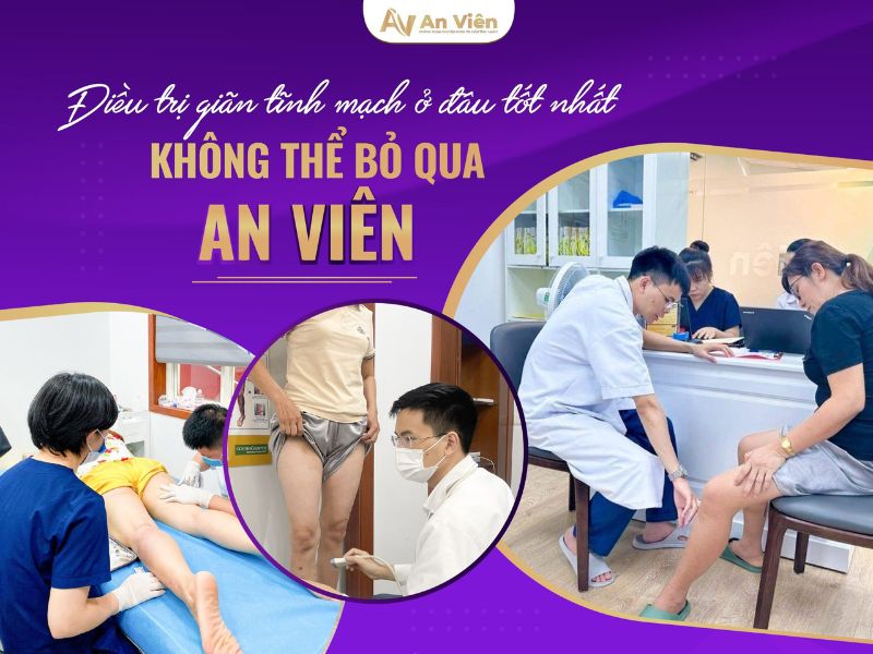 cách làm giảm giãn tĩnh mạch
