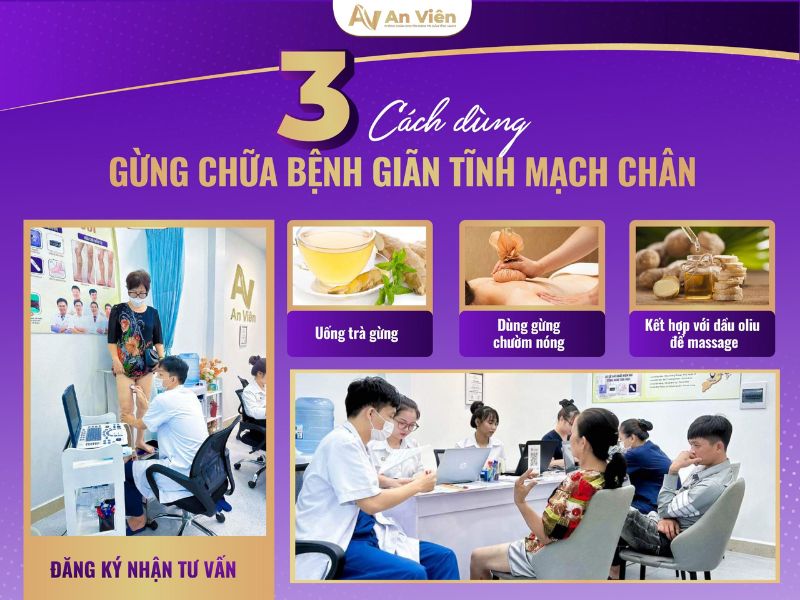 cách phòng chống giãn tĩnh mạch