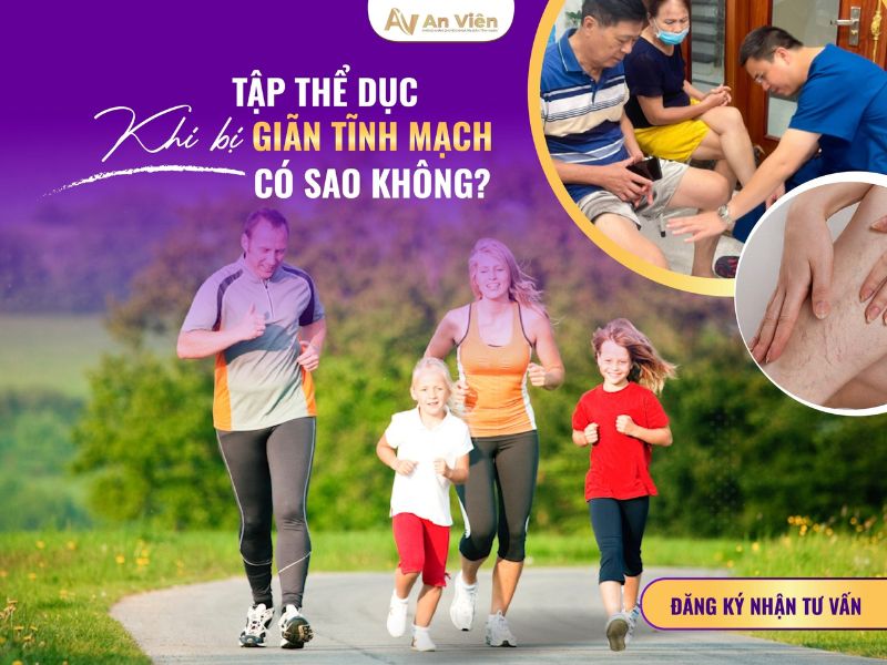 cách tập thể dục giãn tĩnh mạch