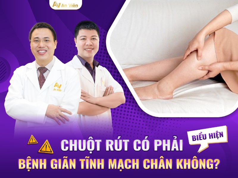 dấu hiệu bệnh giãn tĩnh mạch chi dưới