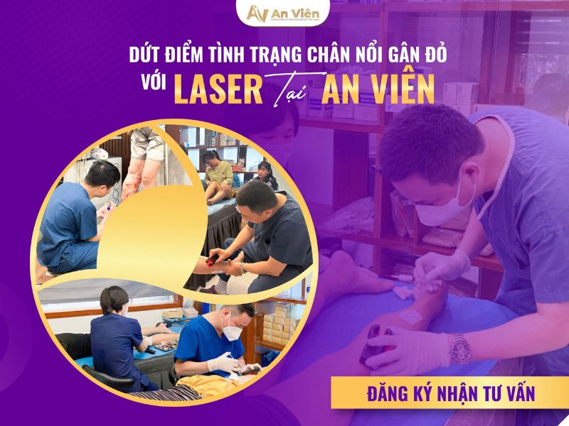dấu hiệu của bệnh giãn tĩnh mạch
