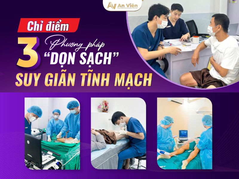 dấu hiệu giãn tĩnh mạch bàn chân