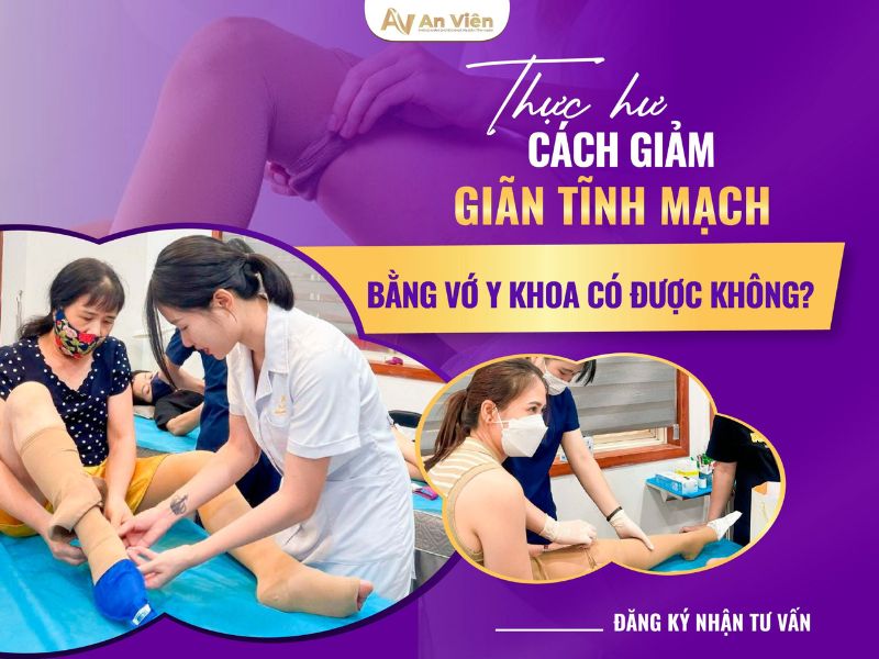 dị dạng mạch máu ở chân
